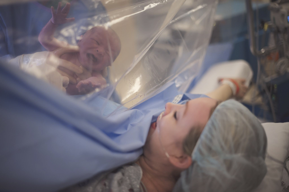 A mother sees her newborn baby through a cesarean section clear drape after being delivered by the best OBGYN in Franklin TN